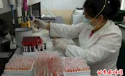 我区集中开展春防抗体效价评估